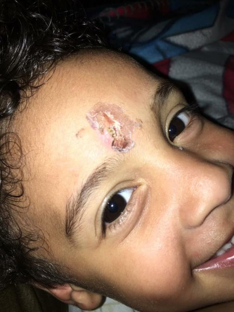 ACS Under Fire After Child Beaten Into A Coma Three Days After Tip-Off About Abuse