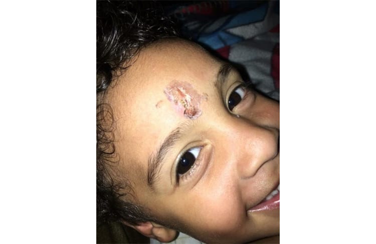 ACS Under Fire After Child Beaten Into A Coma Three Days After Tip-Off About Abuse