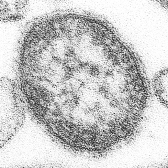 A Microscopic Look at the Measles Virus (Source: Center For Disease Control via Wikimedia Commons)